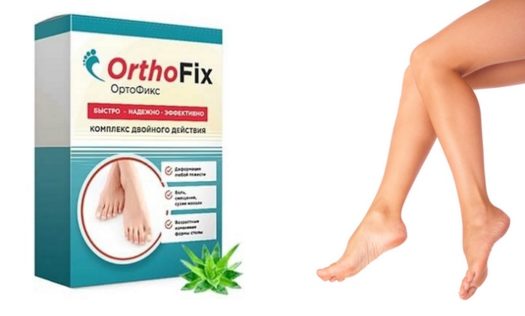ORTHOFIX: эффективное средство для борьбы с вальгусом