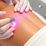 Лазерная эпиляция: что это, как работает и стоит ли пробовать