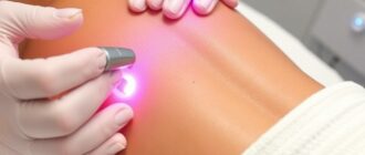 Лазерная эпиляция: что это, как работает и стоит ли пробовать