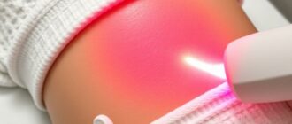 Лазерная эпиляция: как это работает и чего на самом деле ждать